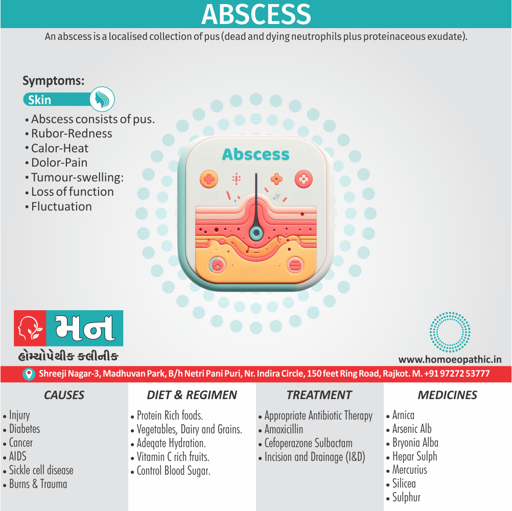 Abscess Treatment & Homeopathic Remedies at Mann Homeopathic Clinic Understanding Abscesses: Causes, Symptoms & Homeopathic Approach An infographic explaining abscesses, their causes, and symptoms, highlighting homeopathic treatment options available at Mann Homeopathic Clinic, Gujarat, India.