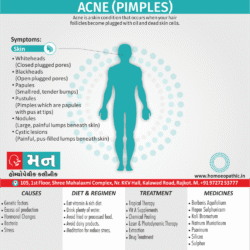 Acne Pimples Definition Symptoms Cause Diet Regimen Homeopathic Medicine Homeopath Treatment In Rajkot India