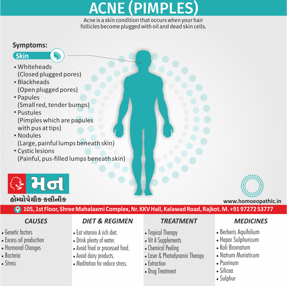 Acne (Pimples) Definition Symptoms Cause Diet Regimen Homeopathic Medicine Homeopath Treatment In Rajkot India