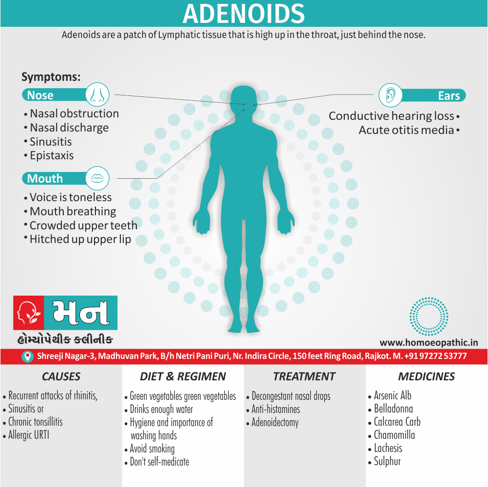 Adenoids Definition Symptoms Cause Diet Regimen Homeopathic Medicine Homeopath Treatment in Rajkot India