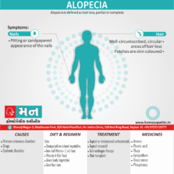 Alopecia Definition Symptoms Cause Diet Homeopathic Medicine Treatment Homeopathy Doctor Clinic in Rajkot Gujarat India
