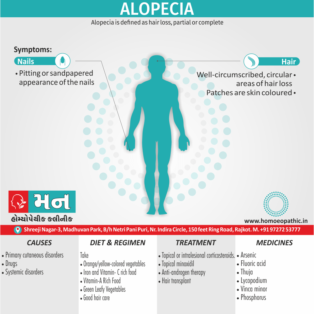 Alopecia - Mann Homeopathy Clinic Rajkot