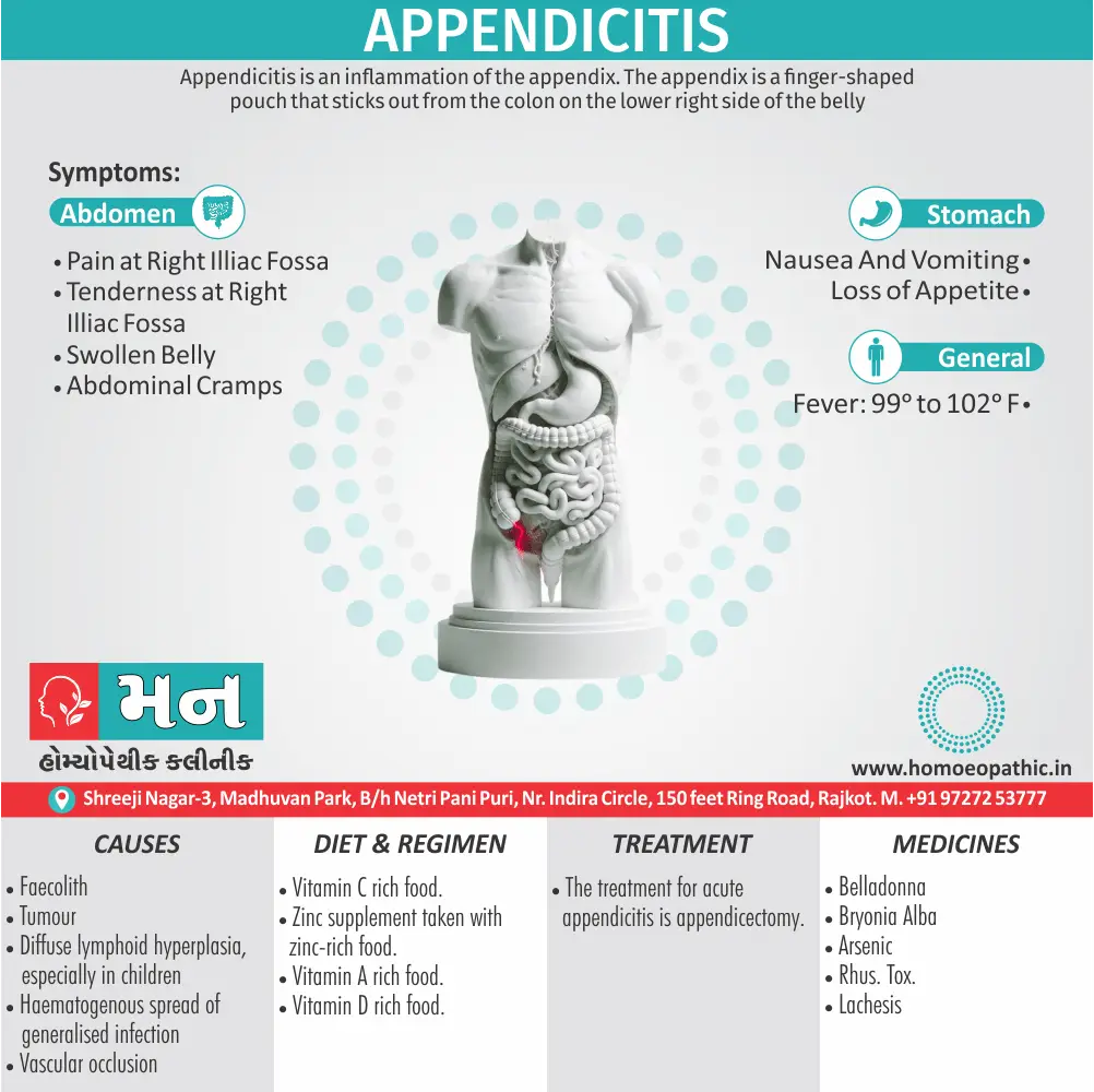 Appendicitis Symptoms Cause Homeopathic Medicine Homeopath Treatment in Rajkot Gujarat India