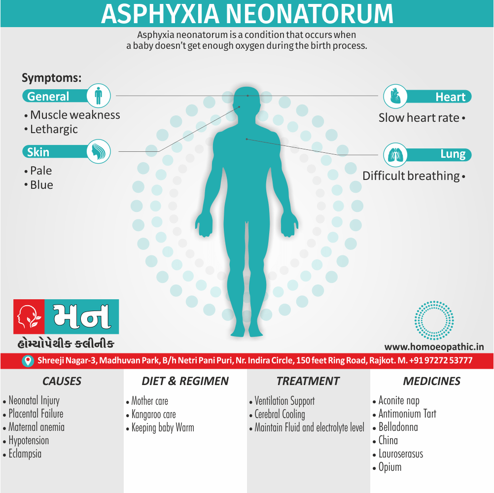 Asphyxia Neonatorum Definition Symptoms Cause Diet Regimen Homeopathic Medicine Homeopath Treatment in Rajkot India