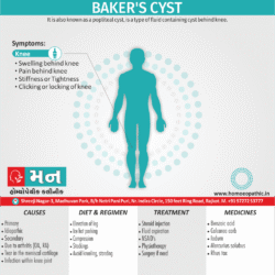 Baker&rsquo;s cyst Definition Symptoms Cause Diet Regimen Homeopathic Medicine Homeopath Treatment in Rajkot India