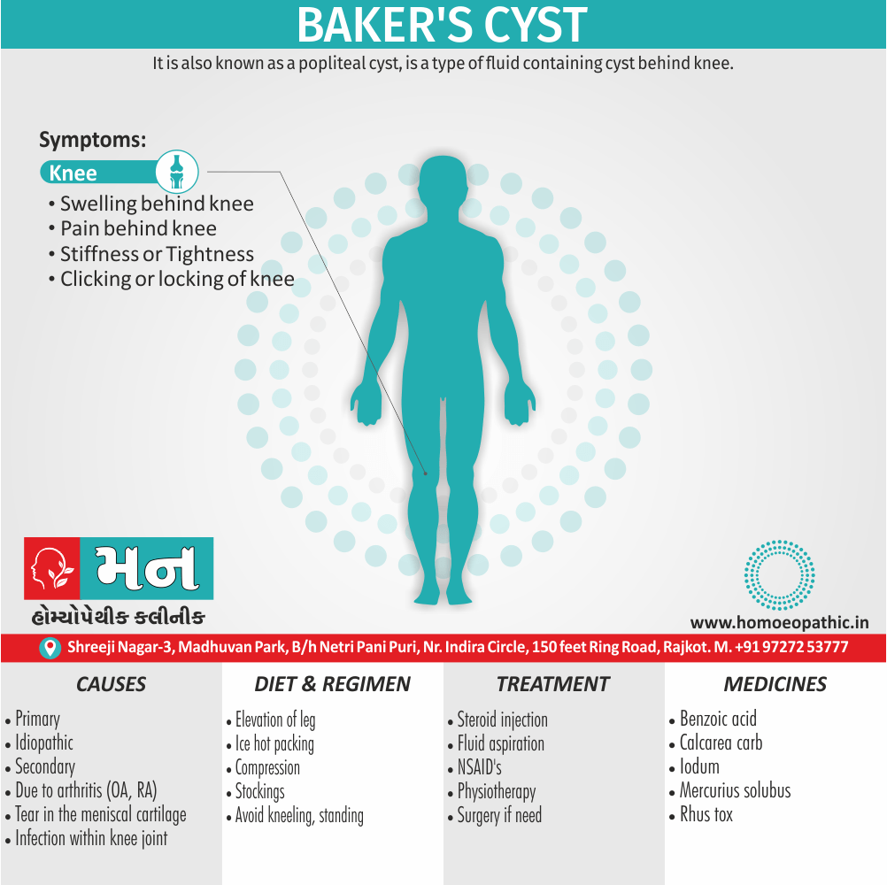 Baker’s cyst Definition Symptoms Cause Diet Regimen Homeopathic Medicine Homeopath Treatment in Rajkot India