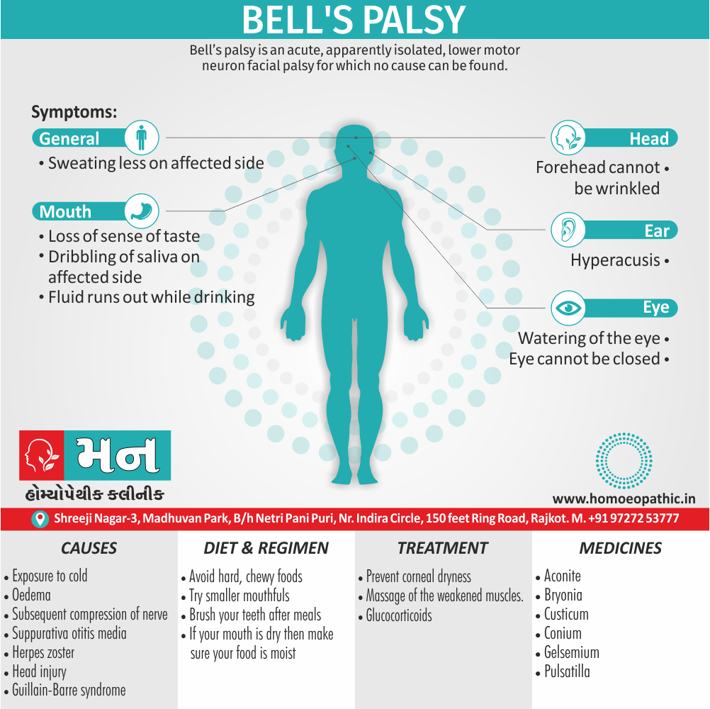 Bell's Palsy Definition Symptoms Cause Diet Regimen Homeopathic Medicine Homeopath Treatment in Rajkot India