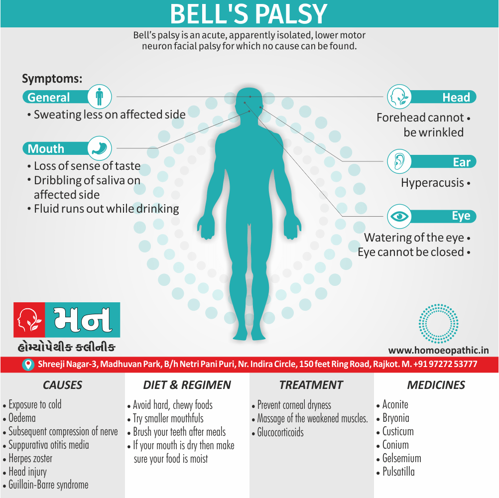 What is the definition of Bell's palsy? What are the causes and