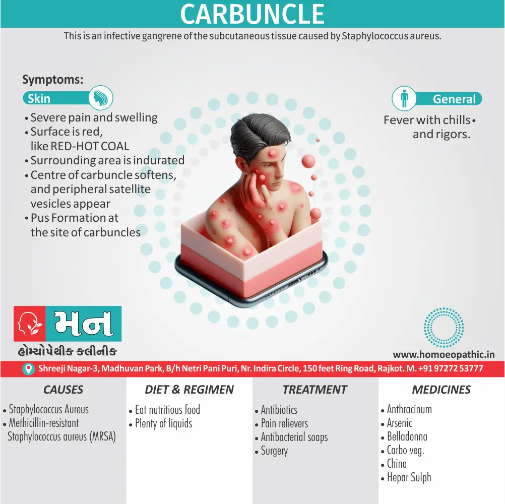 Carbuncle Symptoms Cause Homeopathic Medicine Homeopath Treatment in Rajkot Gujarat India