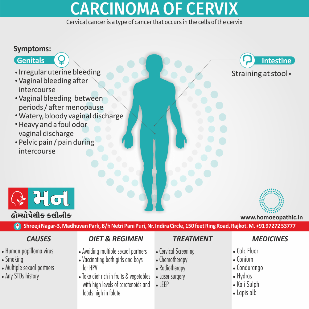 Carcinoma of cervix Definition Symptoms Cause Diet Regimen Homeopathic Medicine Homeopath Treatment in Rajkot India