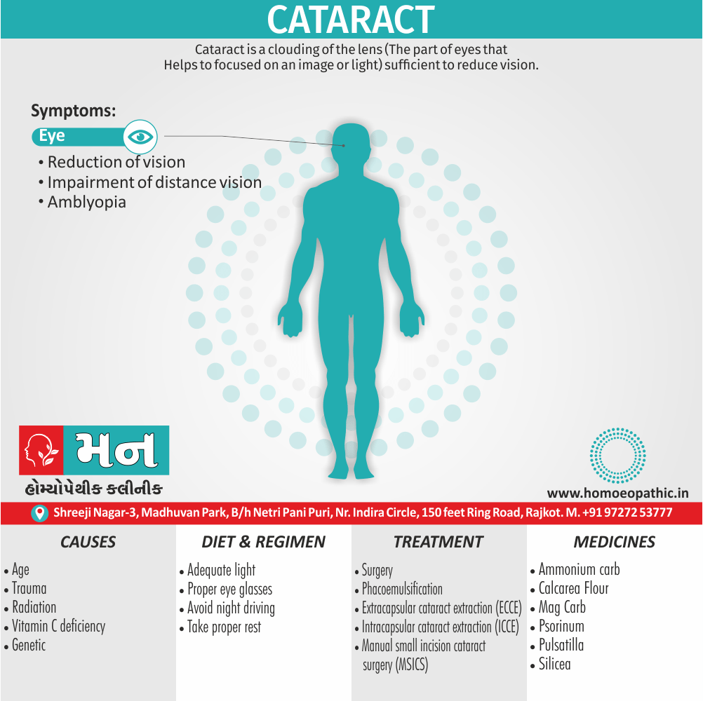Cataract Definition Symptoms Cause Diet Regimen Homeopathic Medicine Homeopath Treatment in Rajkot India