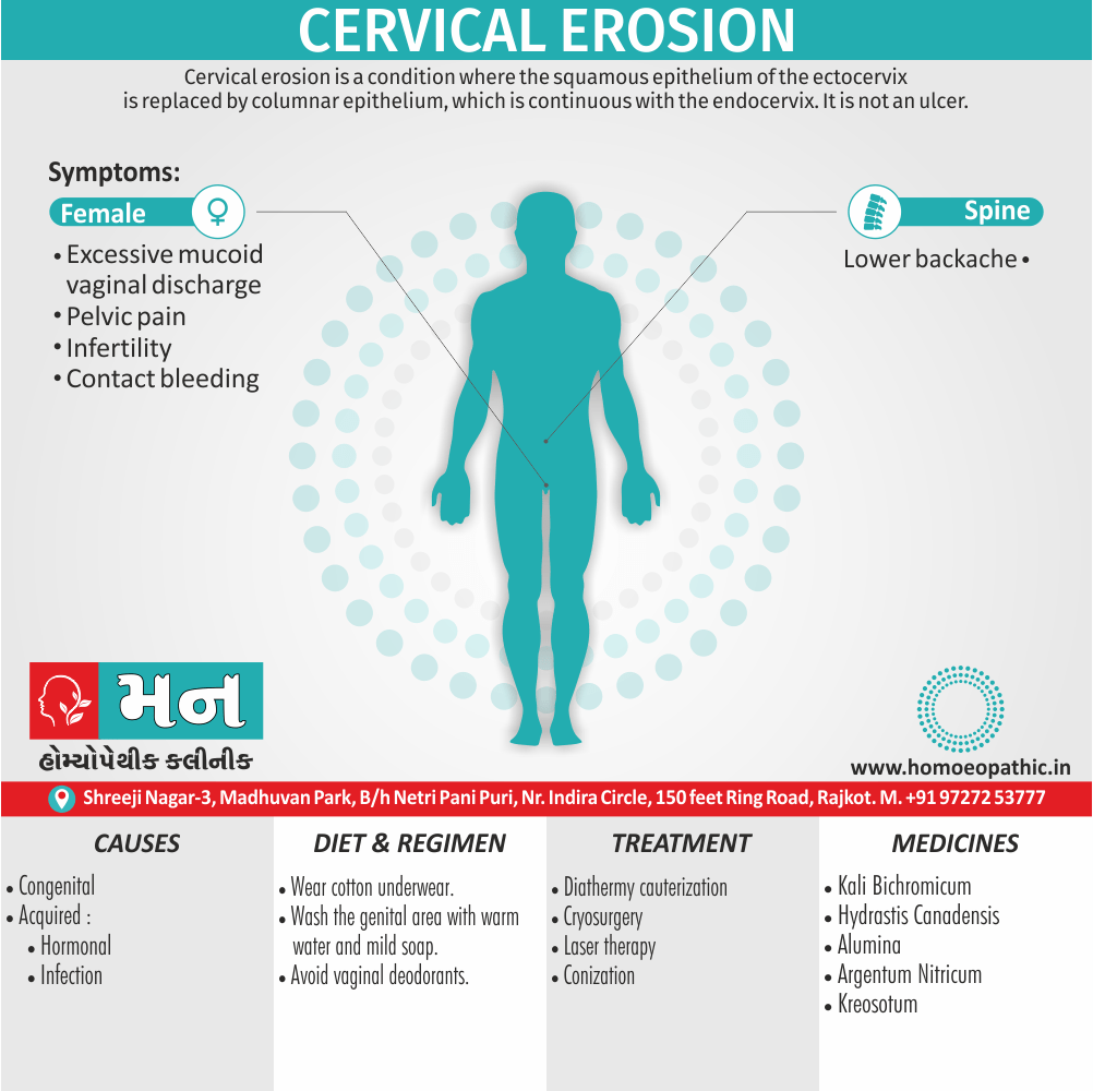 Cervical Erosion Definition Symptoms Cause Diet Homeopathic Medicine Treatment Homeopathy Doctor Clinic in Rajkot Gujarat India