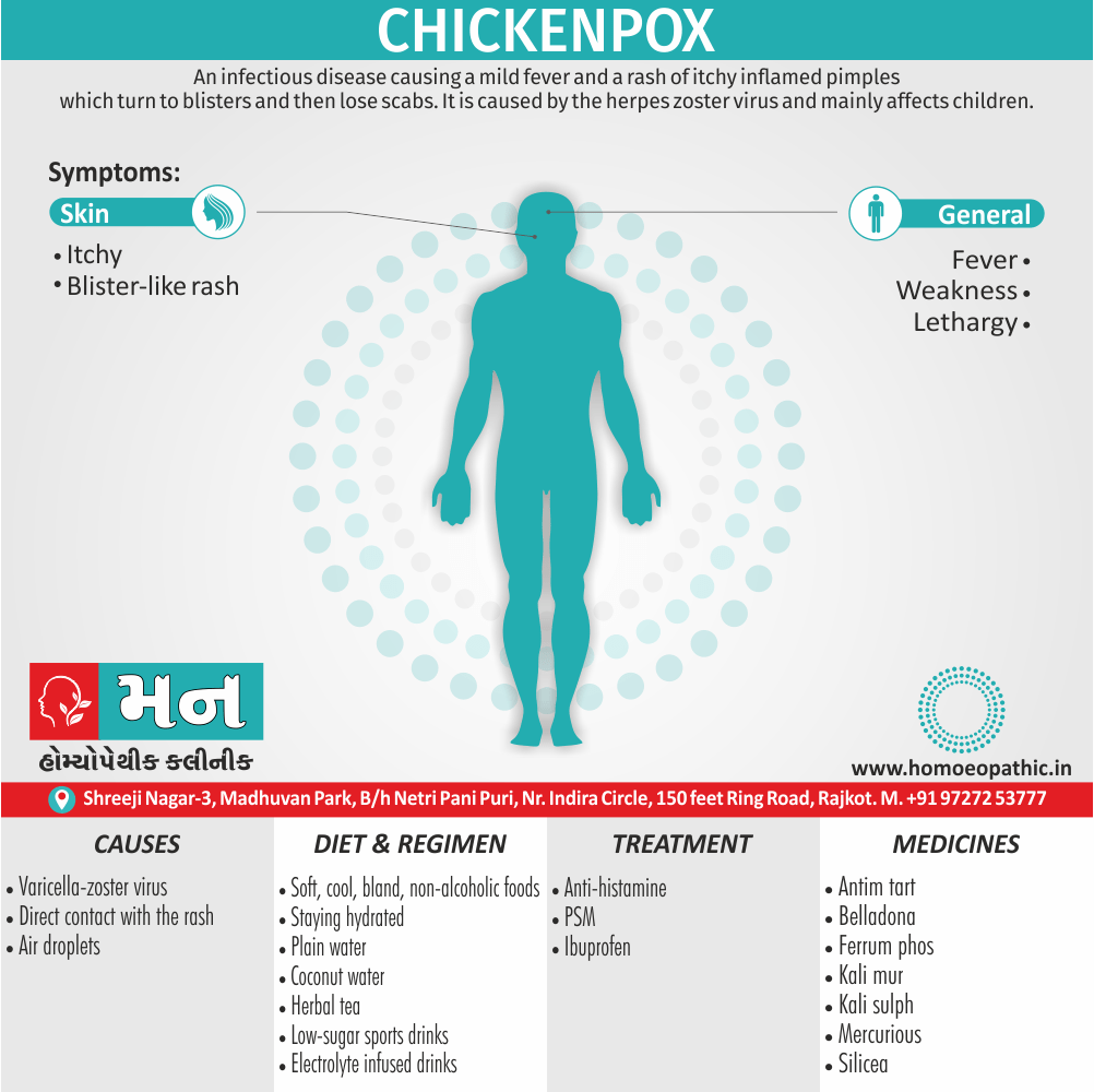 Chickenpox Definition Symptoms Cause Diet Regimen Homeopathic Medicine Homeopath Treatment in Rajkot India
