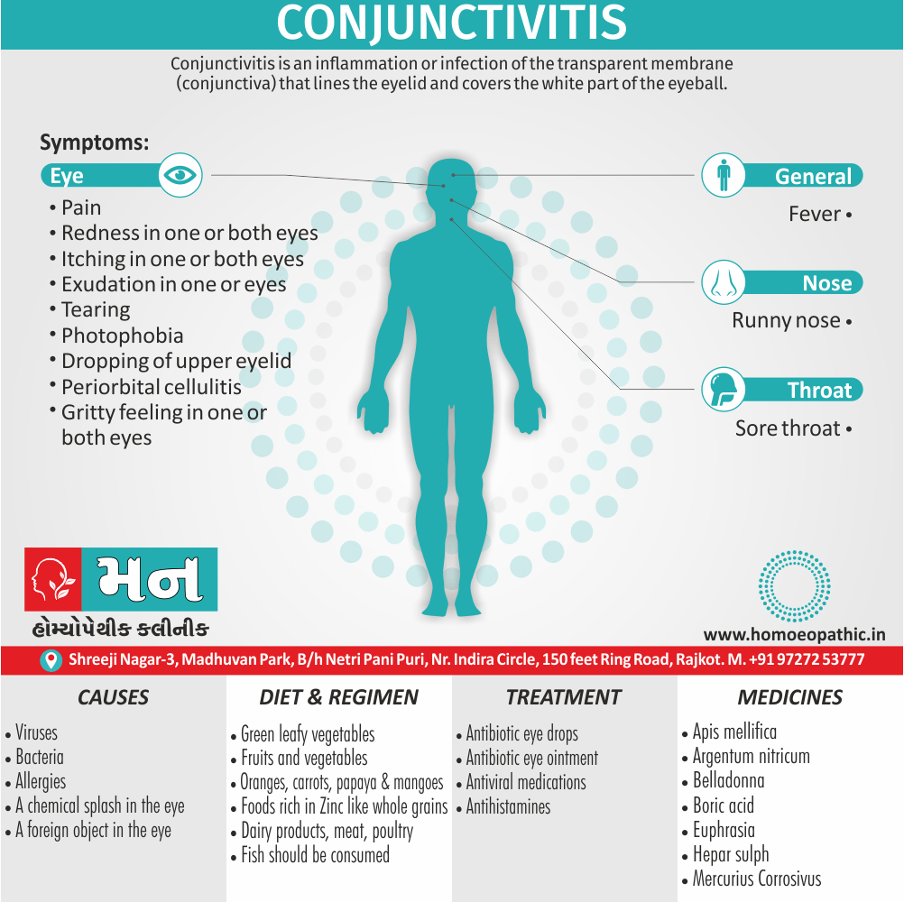 Conjunctivitis Definition Symptoms Cause Diet Regimen Homeopathic Medicine Homeopath Treatment in Rajkot India