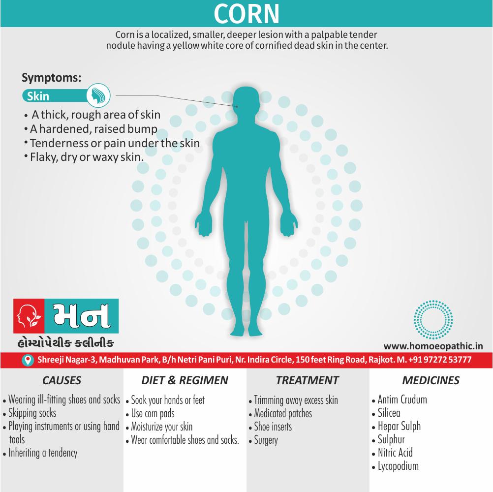Corn Definition Symptoms Cause Diet Homeopathic Medicine Treatment Homeopathy Doctor Clinic in Rajkot Gujarat India