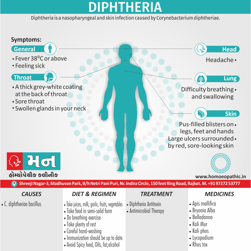 Diphtheria Definition Symptoms Cause Diet Regimen Homeopathic Medicine Homeopath Treatment in Rajkot India