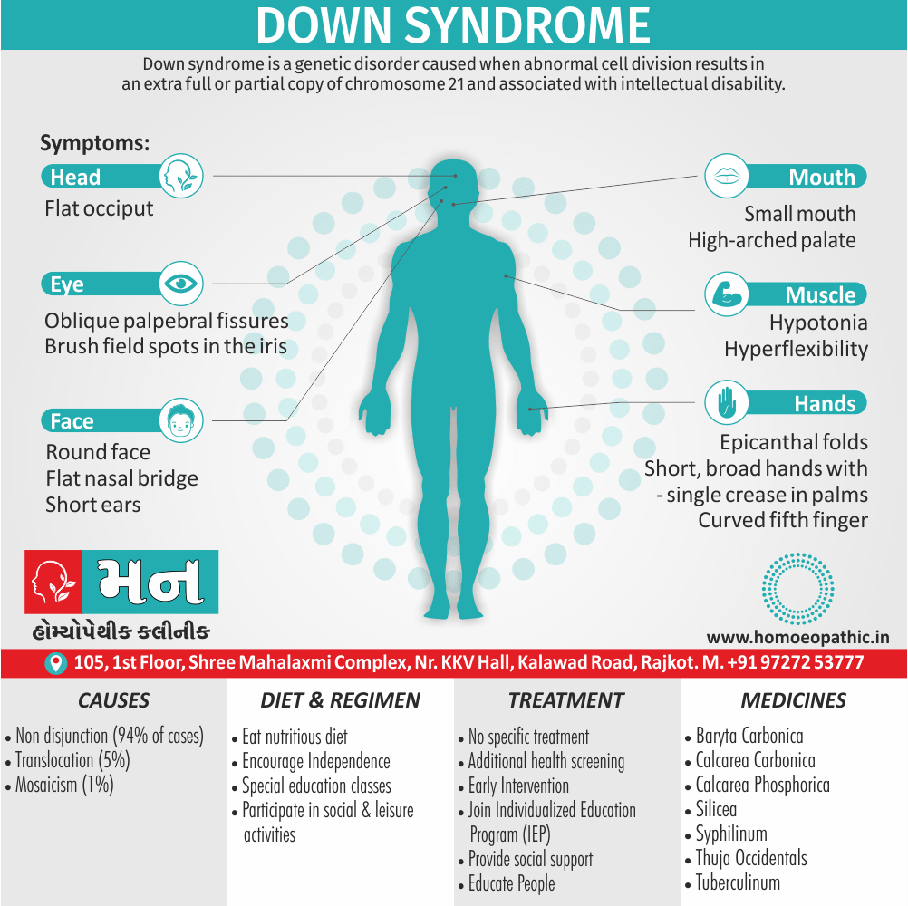 Down Syndrome Definition Symptoms Cause Diet Regimen Homeopathic Medicine Homeopath Treatment In Rajkot India