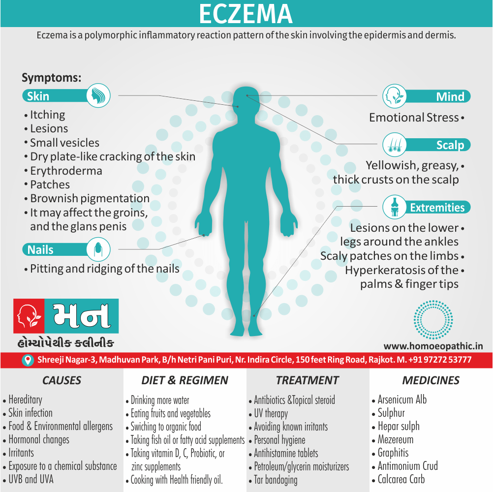 Eczema Definition Symptoms Cause Diet Homeopathic Medicine Treatment Homeopathy Doctor Clinic in Rajkot Gujarat India