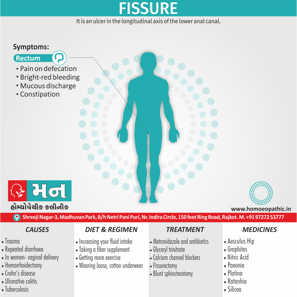 Fissure Definition Symptoms Cause Diet Homeopathic Medicine Treatment Homeopathy Doctor Clinic in Rajkot Gujarat India