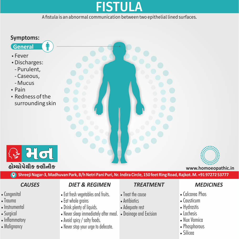 Fistula Definition Symptoms Cause Diet Homeopathic Medicine Treatment Homeopathy Doctor Clinic in Rajkot Gujarat India