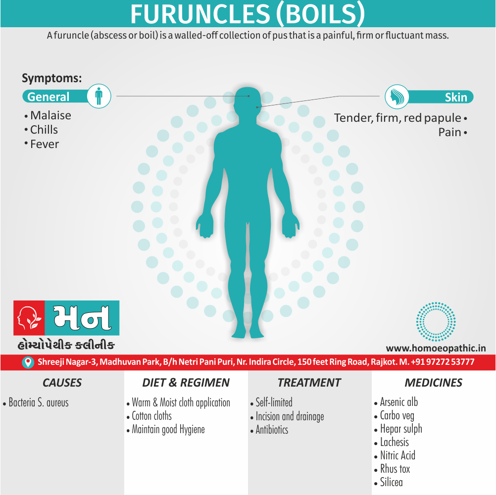 Furuncles (Boils) Definition Symptoms Cause Diet Homeopathic Medicine Treatment Homeopathy Doctor Clinic in Rajkot Gujarat India