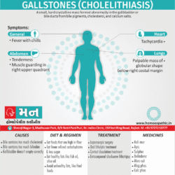 Gallstones Definition Symptoms Cause Diet Regimen Homeopathic Medicine Homeopath Treatment in Rajkot India
