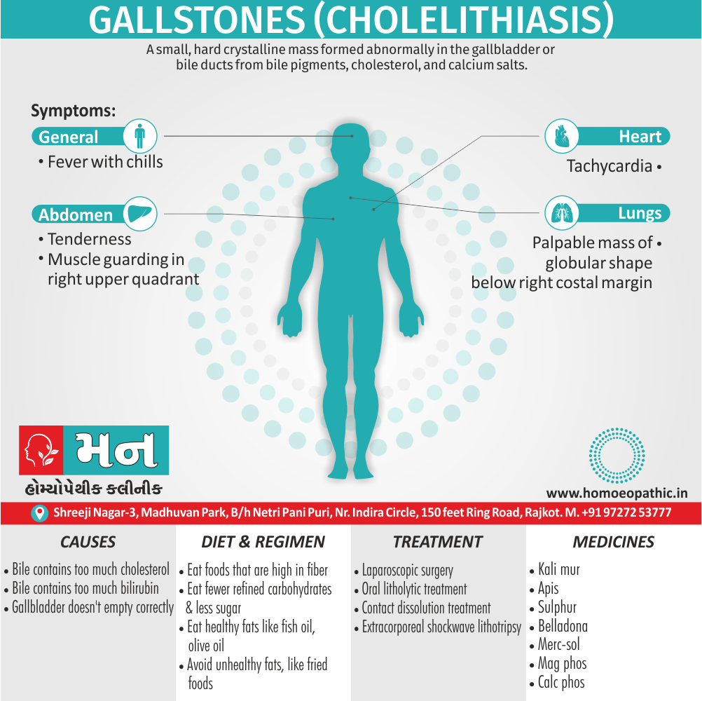 Gallstones Definition Symptoms Cause Diet Regimen Homeopathic Medicine Homeopath Treatment in Rajkot India