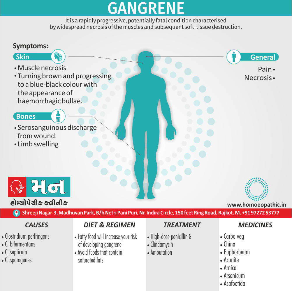 Gangrene Definition Symptoms Cause Diet Regimen Homeopathic Medicine Homeopath Treatment in Rajkot India