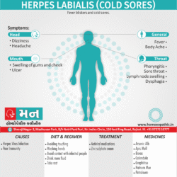 Herpes Labialis (Cold sores) Definition Symptoms Cause Diet Homeopathic Medicine Treatment Homeopathy Doctor Clinic in Rajkot Gujarat India