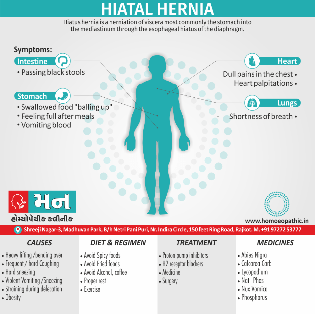 Hiatal Hernia Definition Symptoms Cause Diet Homeopathic Medicine Treatment Homeopathy Doctor Clinic in Rajkot Gujarat India