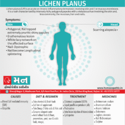 Lichen Planus Definition Symptoms Cause Diet Regimen Homeopathic Medicine Homeopath Treatment in Rajkot India