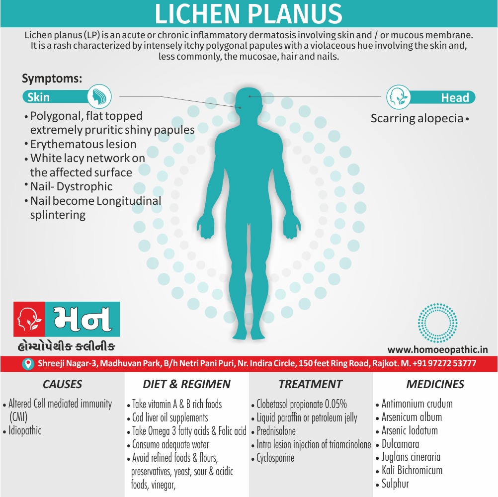 Lichen Planus Definition Symptoms Cause Diet Regimen Homeopathic Medicine Homeopath Treatment in Rajkot India