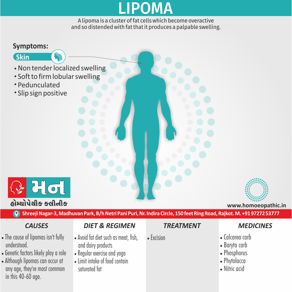 Lipoma Definition Symptoms Cause Diet Homeopathic Medicine Treatment Homeopathy Doctor Clinic in Rajkot Gujarat India