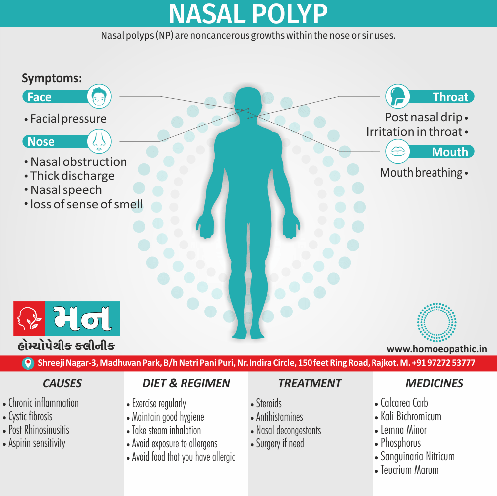 Nasal Polyp Definition Symptoms Cause Diet Regimen Homeopathic Medicine Homeopath Treatment in Rajkot India