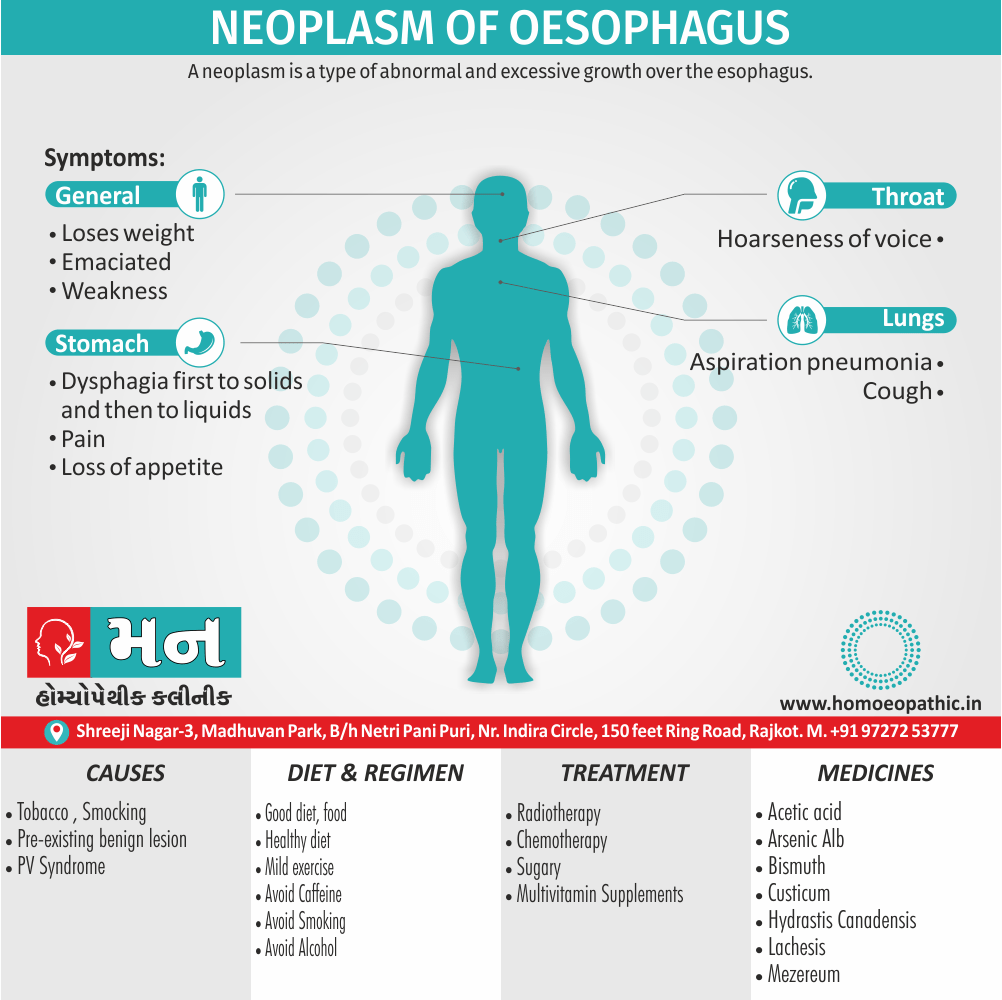 Neoplasm of Oesophagus Cause Diet Homeopathic Medicine Treatment Homeopathy Doctor Clinic in Rajkot Gujarat India