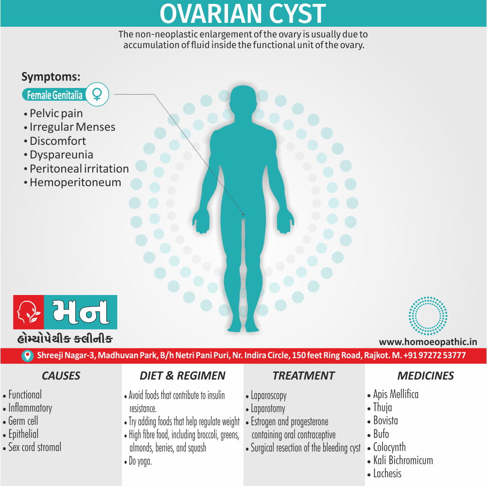 Ovarian Cyst