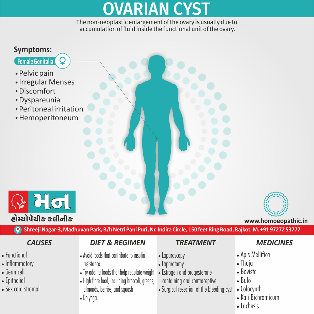 Ovarian Cyst Definition Symptoms Cause Diet Homeopathic Medicine Treatment Homeopathy Doctor Clinic in Rajkot Gujarat India