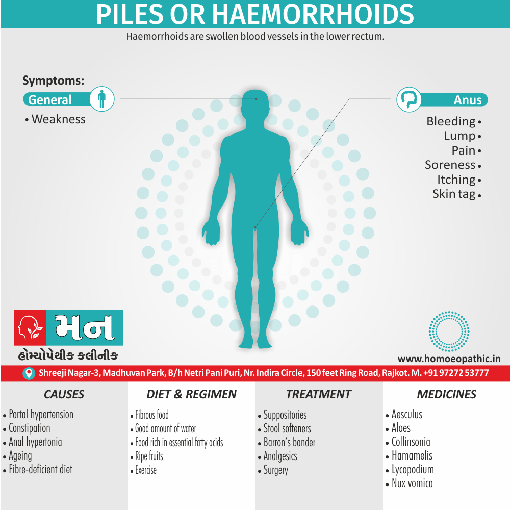 Piles Or Haemorrhoids Cause Diet Homeopathic Medicine Treatment Homeopathy Doctor Clinic in Rajkot Gujarat India