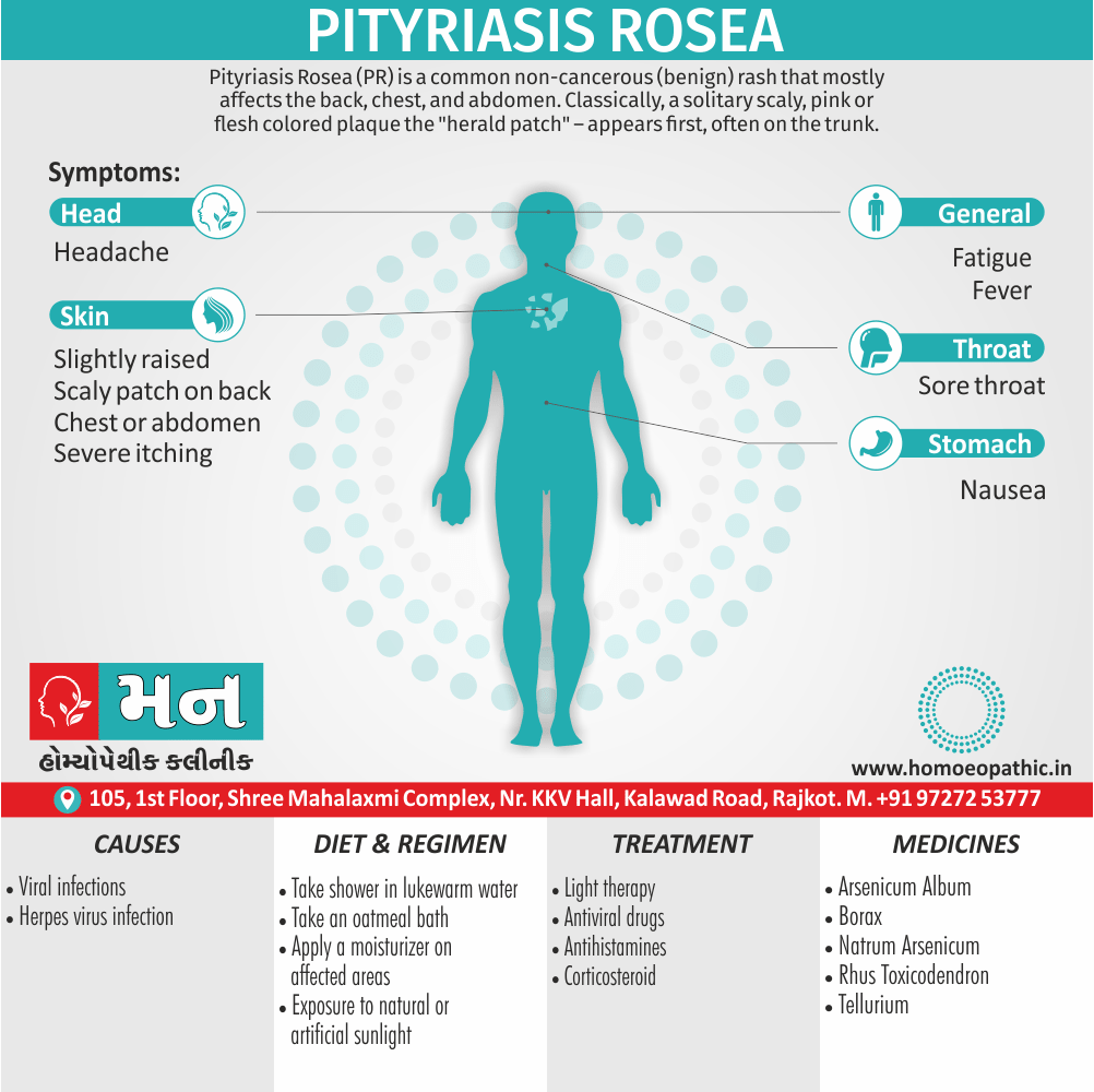 Pityriasis Rosea Treatment