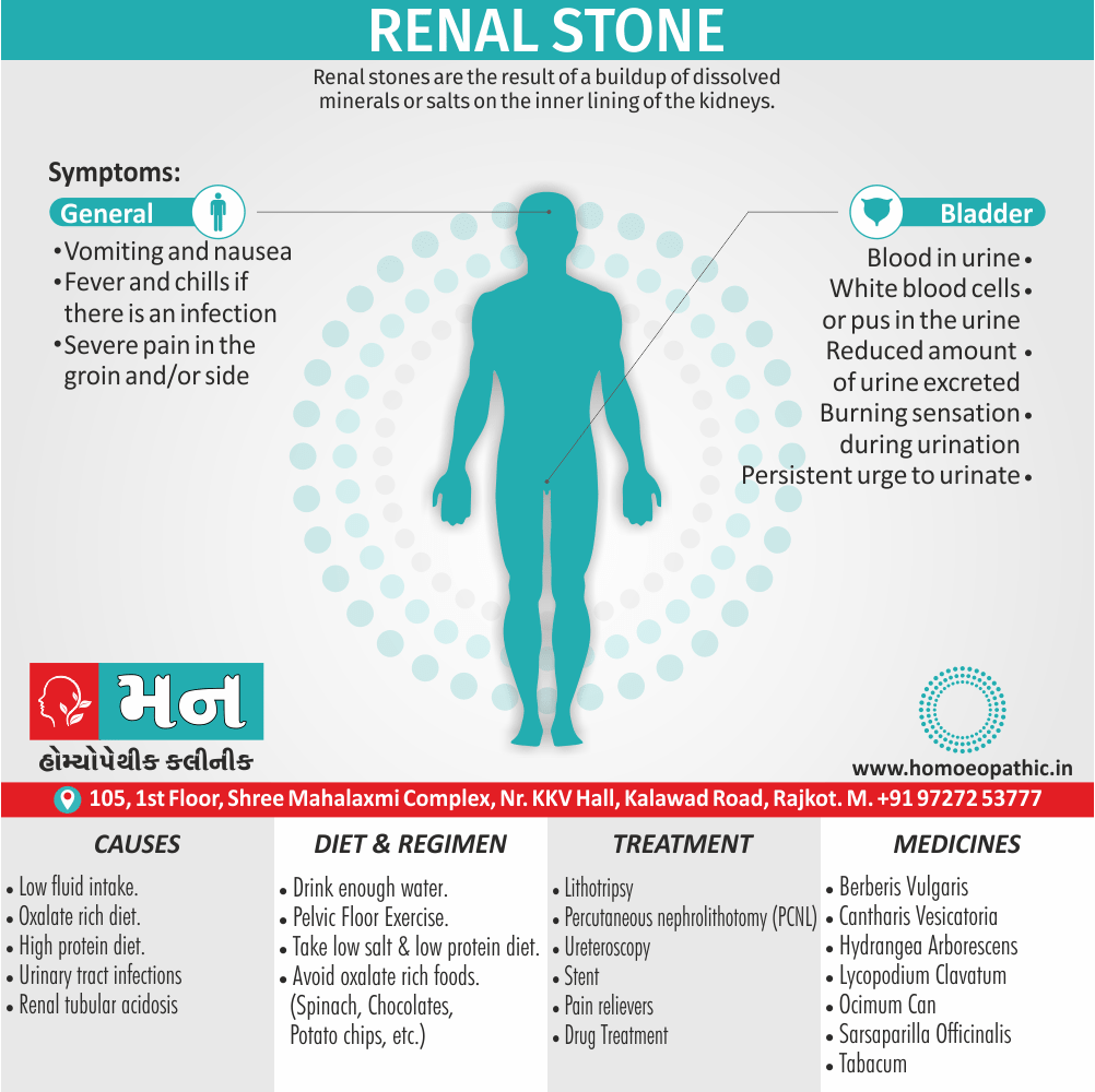 Renal Stone Definition Symptoms Cause Diet Regimen Homeopathic Medicine Homeopath Treatment In Rajkot India