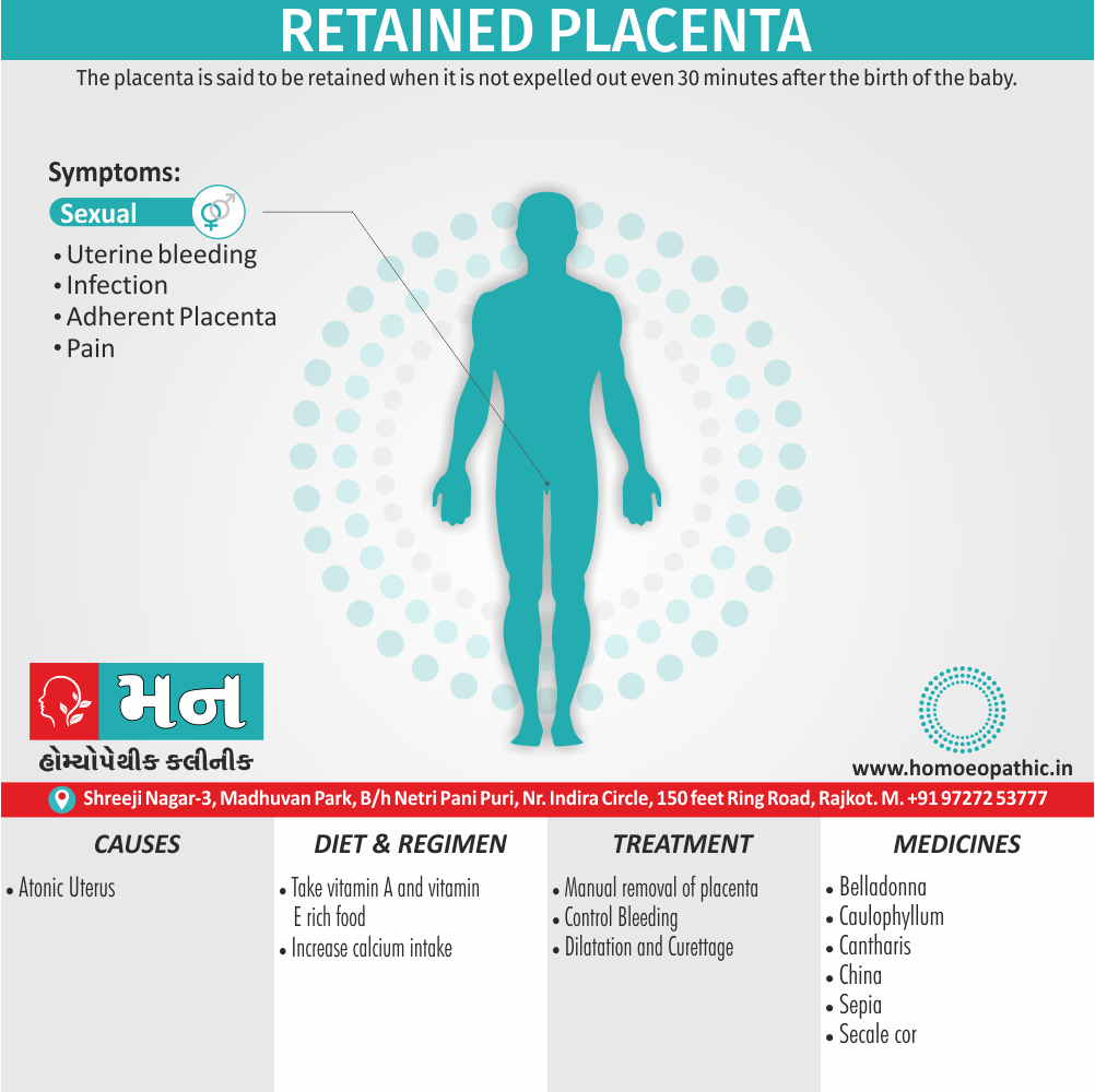 Retained Placenta Cause Diet Homeopathic Medicine Treatment Homeopathy Doctor Clinic in Rajkot Gujarat India