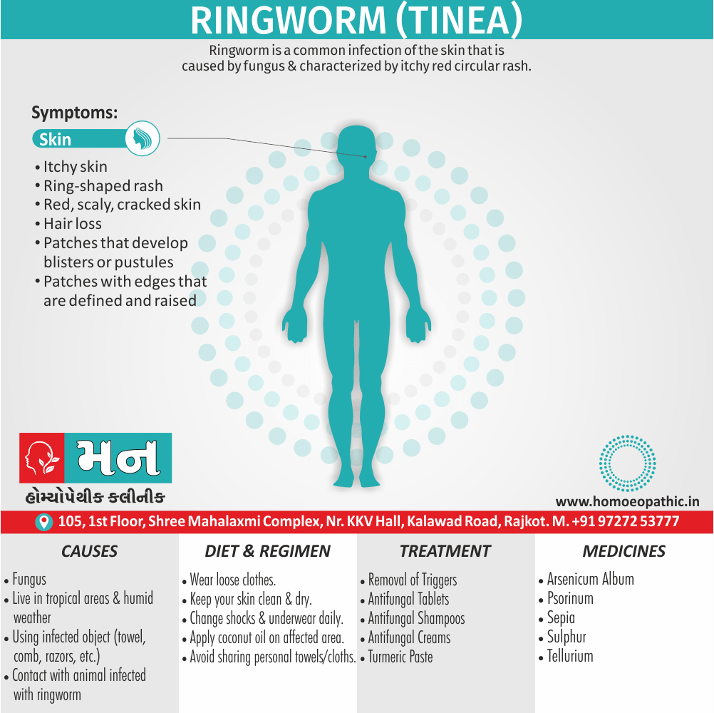 Ringworm Definition Symptoms Cause Diet Regimen Homeopathic Medicine Homeopath Treatment In Rajkot India