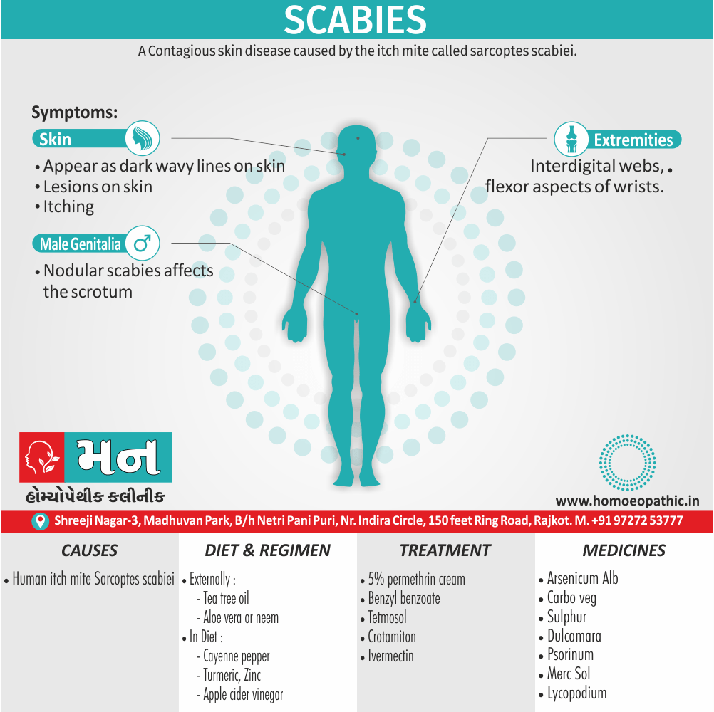 Scabies Definition Symptoms Cause Diet Homeopathic Medicine Treatment Homeopathy Doctor Clinic in Rajkot Gujarat India