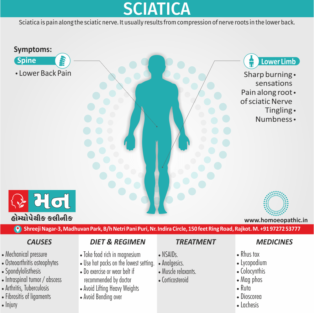 Sciatica Definition Symptoms Cause Diet Homeopathic Medicine Treatment Homeopathy Doctor Clinic in Rajkot Gujarat India