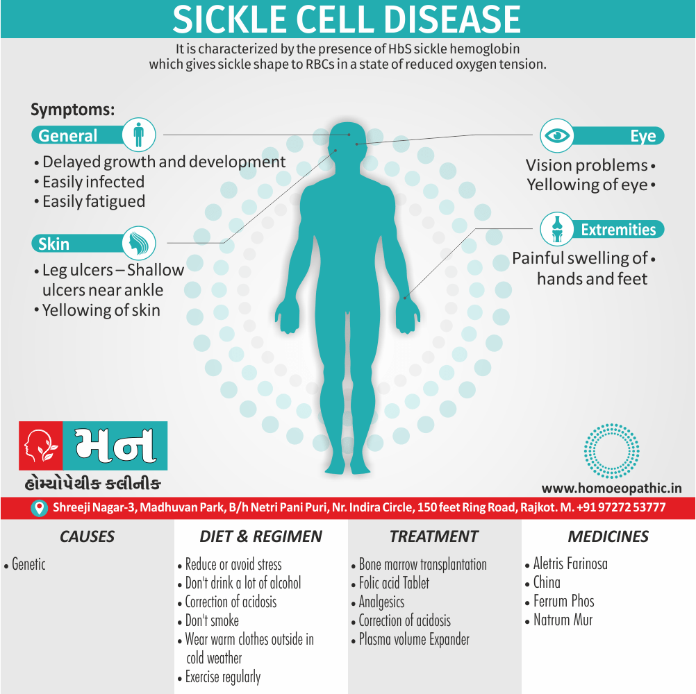 Sickle Cell Disease Definition Symptoms Cause Diet Homeopathic Medicine Treatment Homeopathy Doctor Clinic in Rajkot Gujarat India