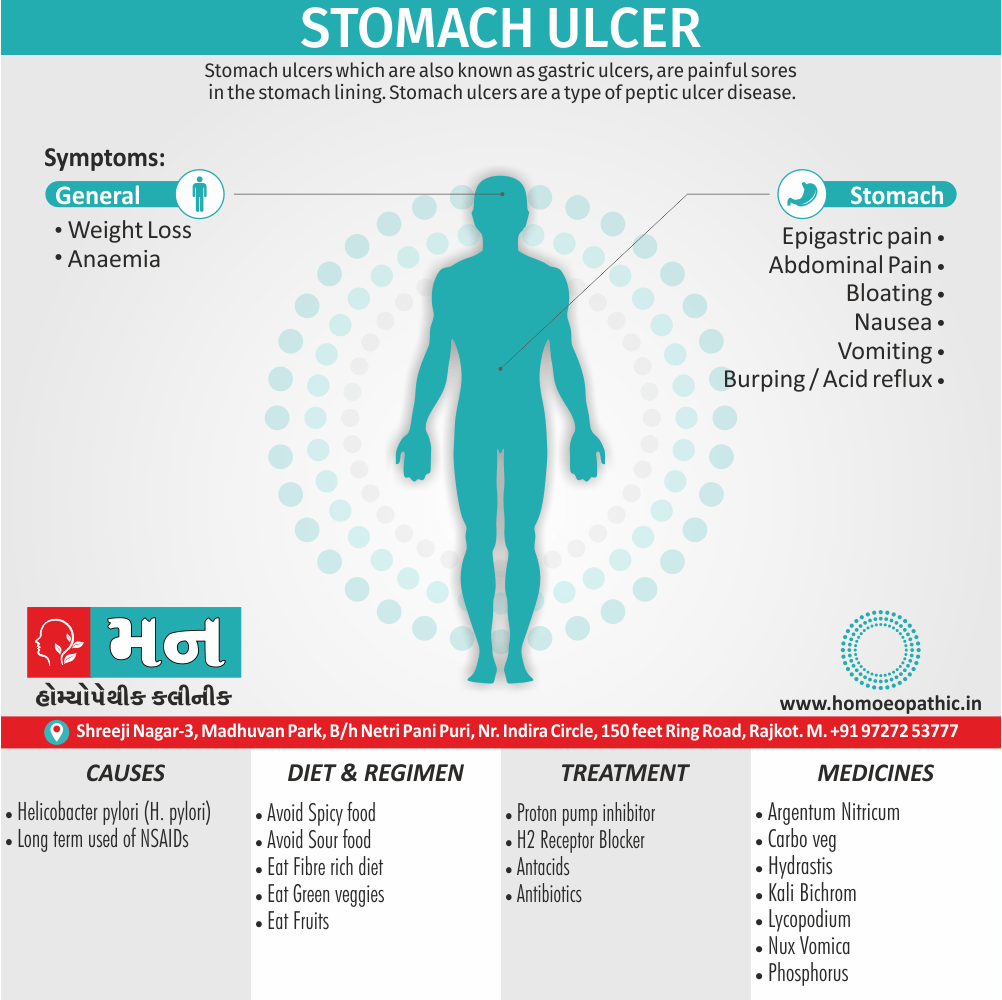 Stomach Ulcer Definition Symptoms Cause Diet Regimen Homeopathic Medicine Homeopath Treatment in Rajkot India
