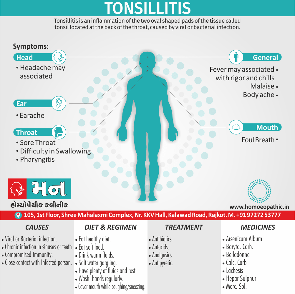 Tonsillitis Definition Symptoms Cause Diet Regimen Homeopathic Medicine Homeopath Treatment in Rajkot India