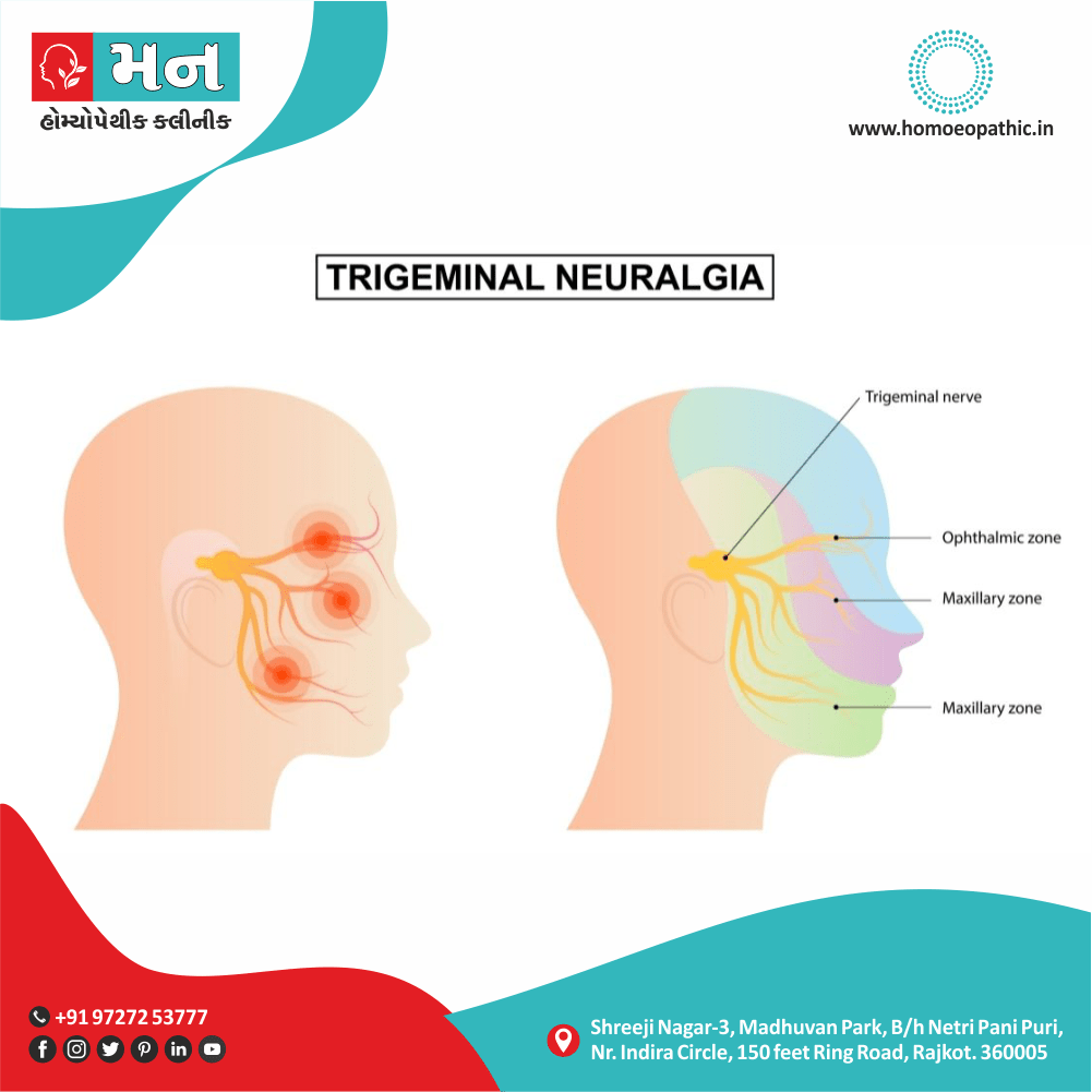 Trigeminal Neuralgia Definition Symptoms Cause Diet Homeopathic Medicine Treatment Homeopathy Doctor Clinic in Rajkot Gujarat India