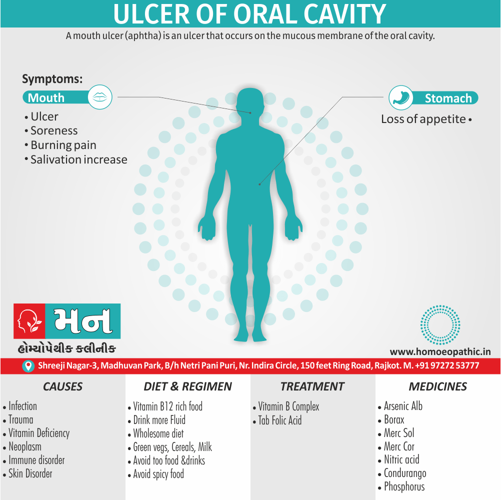 Ulcer of Oral Cavity Cause Diet Homeopathic Medicine Treatment Homeopathy Doctor Clinic in Rajkot Gujarat India