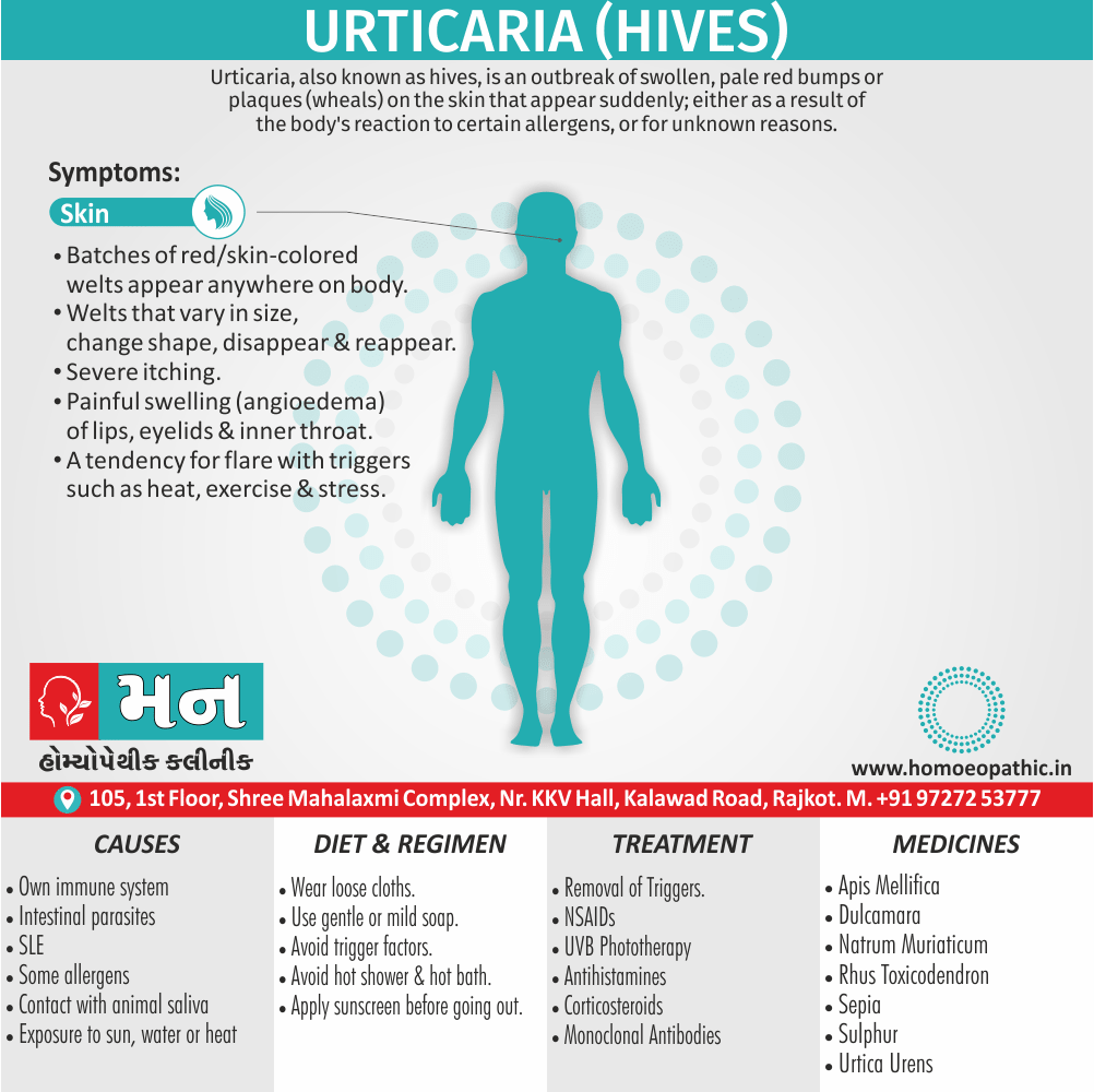 Urticaria (Hives) Definition Symptoms Cause Diet Regimen Homeopathic Medicine Homeopath Treatment In Rajkot India